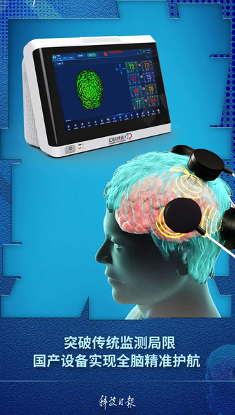 全球首创！精准监测，守护“大脑生命线”